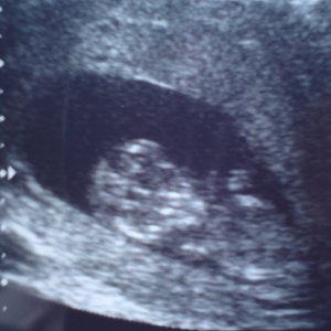 Baby @ 12 weeks