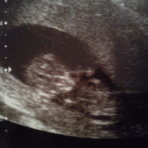 Baby @ 12 weeks 2