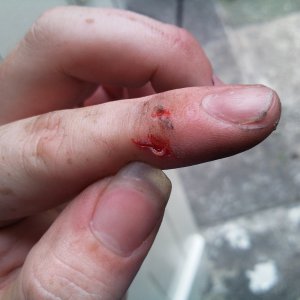 Cut finger